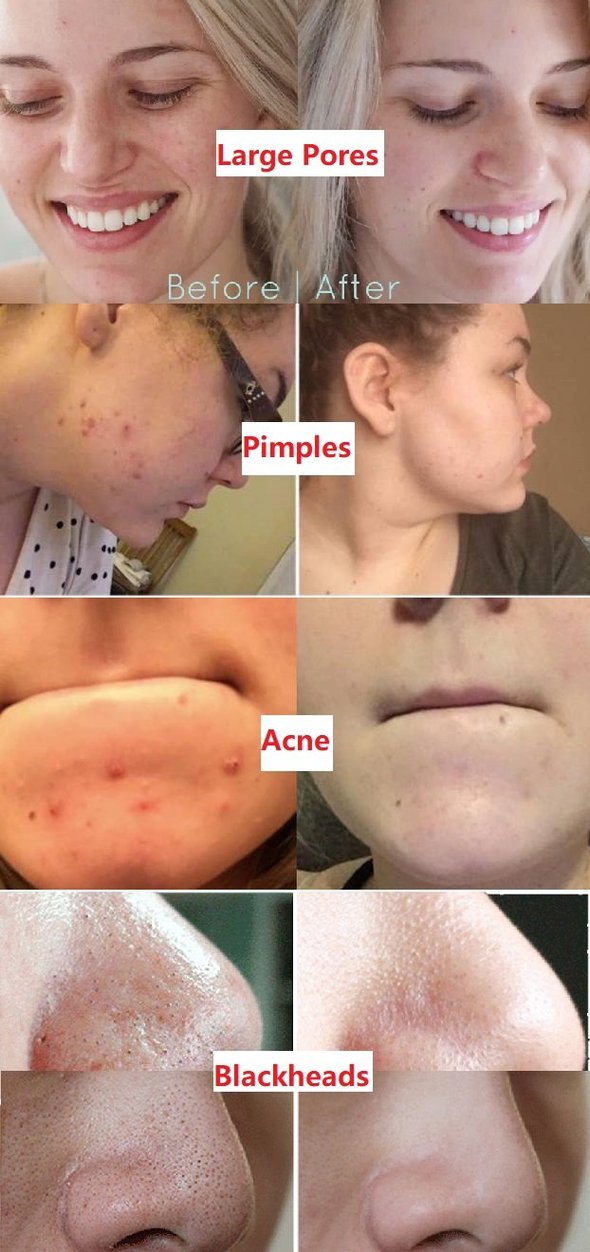 Diystar™ Green Tea Deep Cleanse Mask Stick