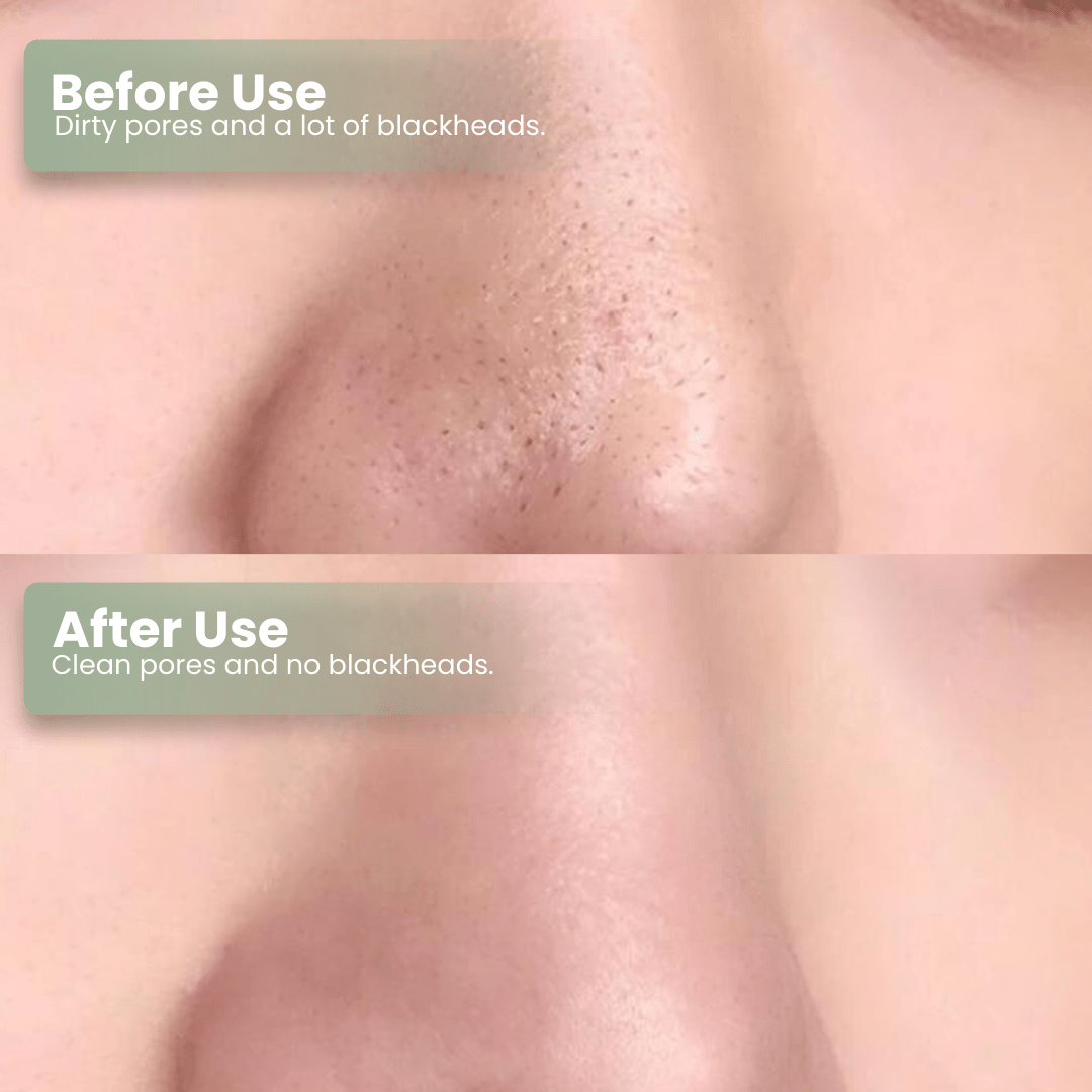 LUHAKA® Green Tea Deep Cleanse Mask Stick ACE 1