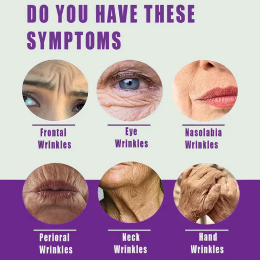 SEAGRIL-PEPTIDE Wrinkle Reducing Cream contains 12 different peptides (eliminates wrinkles in 1 minute)