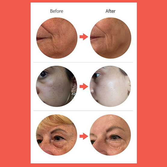 [DERMALINE] PDRN Solution Salmon Ampoule 35ml