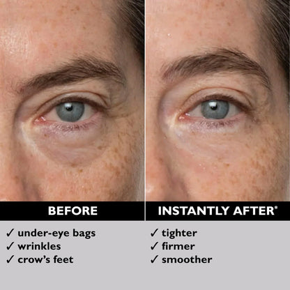 Eye Bag Quick Eraser, Tightens, Firms, & Blurs Wrinkles