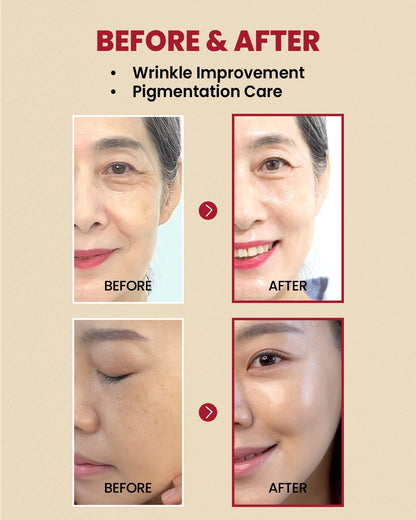 KSECRET | SEOUL 1988 Serum : Retinal Liposome 2% + Black Gingeng, 30ml/1.01fl.oz | 58% Black Gingeng Extract with Retinal, Bakuchiol, Vitamin C & 3 Peptides for Wrinkle Care | Korean Skincare |