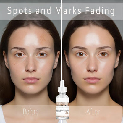 Glutathione Serum,20000ppm Glutathione and Hyaluronic Acid Korean Face Serums for Women Dark Spot Serum Improve Skin Elasticity Reduces Hyperpigmentation,Fine Lines & Wrinkles