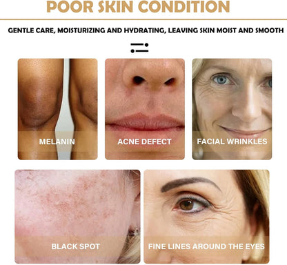 Turmeric Dark Spot Corrector Serum, Bright Skin Dark Spot Corrector Face Whitening Serum Turmeric Repair Face Serum Skin Care Reduce Fine Lines Moisturizing Anti-aging Repair Serum for Face Body