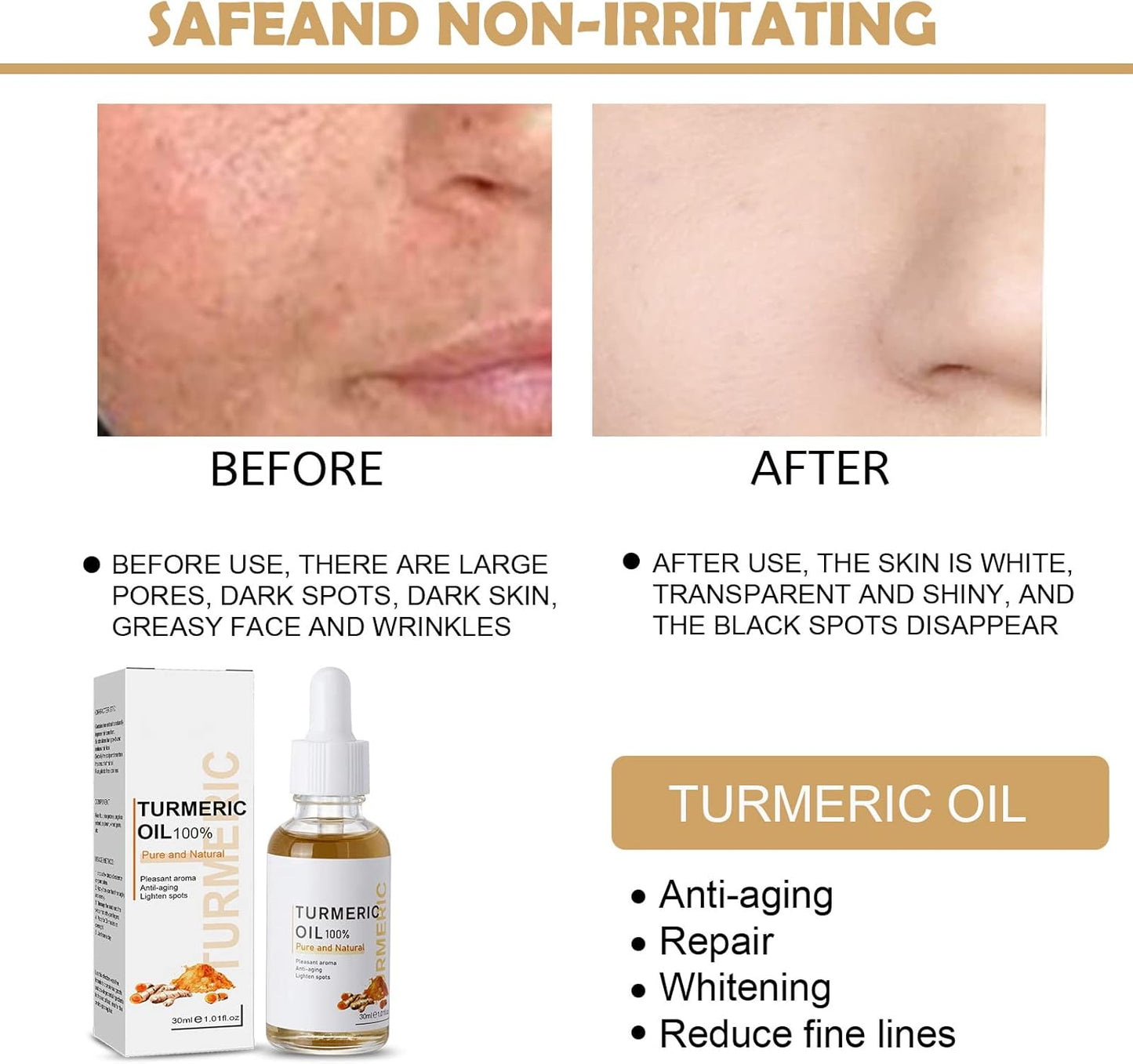 Turmeric Dark Spot Corrector Serum, Bright Skin Dark Spot Corrector Face Whitening Serum Turmeric Repair Face Serum Skin Care Reduce Fine Lines Moisturizing Anti-aging Repair Serum for Face Body