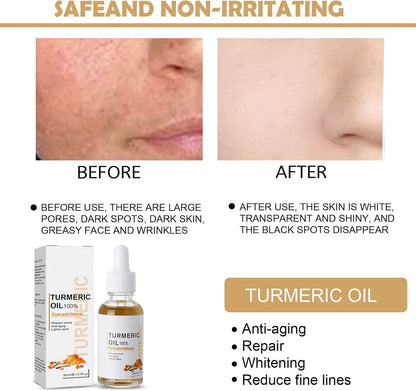 Turmeric Dark Spot Corrector Serum, Bright Skin Dark Spot Corrector Face Whitening Serum Turmeric Repair Face Serum Skin Care Reduce Fine Lines Moisturizing Anti-aging Repair Serum for Face Body
