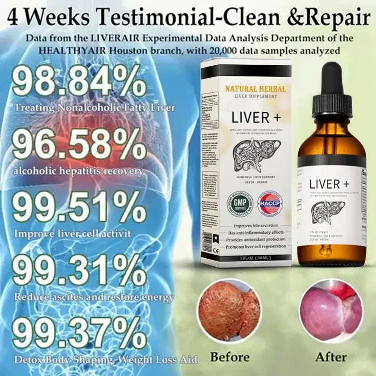 𝐀𝐧𝐧𝐢𝐞𝐂𝐚𝐫𝐞® 𝐍𝐚𝐭𝐮𝐫𝐚𝐥 𝐇𝐞𝐫𝐛𝐚𝐥 𝐋𝐢𝐯𝐞𝐫 𝐒𝐮𝐩𝐩𝐥𝐞𝐦𝐞𝐧𝐭 - 𝐏𝐨𝐰𝐞𝐫𝐟𝐮𝐥 𝐋𝐢𝐯𝐞𝐫 𝐒𝐮𝐩𝐩𝐨𝐫𝐭 - 𝐃𝐞𝐭𝐨𝐱 & 𝐑𝐞𝐩𝐚𝐢𝐫 - 𝐋𝐨𝐰𝐞𝐫𝐬 𝐁𝐥𝐨𝐨𝐝 𝐒𝐮𝐠𝐚𝐫 𝐚𝐧𝐝 𝐋𝐢𝐩𝐢𝐝𝐬