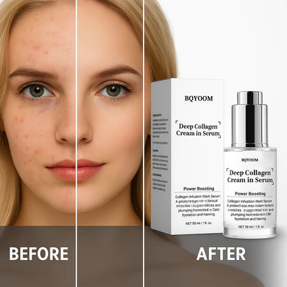 BQYOOMTM Collagen Anti-Wrinkle Cream